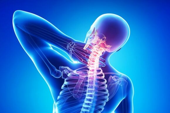 osteocondrosi