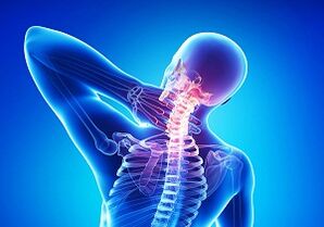 Probabili complicanze con una giunzione di osteocondosi