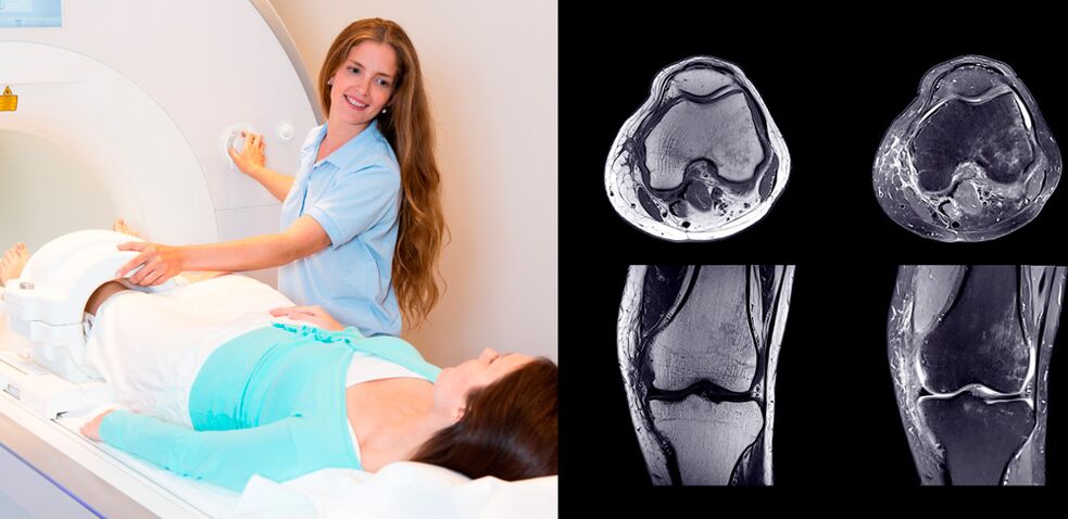 diagnosi dell'articolazione del ginocchio