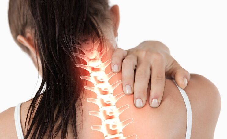 L'osteocondrosi cervicale è caratterizzata da tensione e dolore al collo