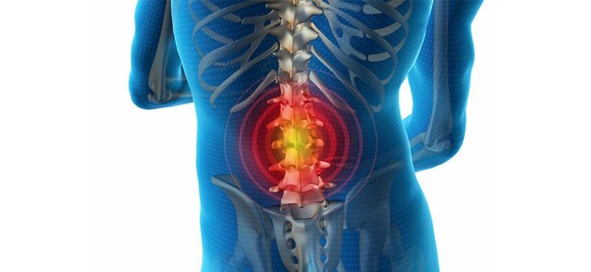 Metodi per diagnosticare il mal di schiena